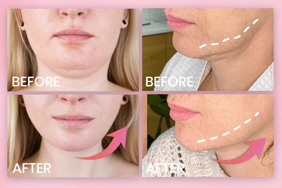 Marbella Invisible Face Lifting Tape